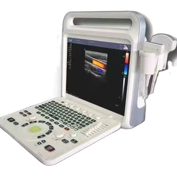 Портативная 15-дюймовая цифровая система 2d 3d 4d, ультразвуковой доплеровский аппарат с человеческим цветом, ультразвуковой сканер для больницы