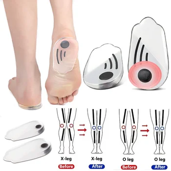 Силиконовые Ортопедические Стельки для Обуви Мужчины Женщины Облегчение Подошвенного Фасцита Уход За Ногами O/X Ноги Коррекция Коленного Варуса Колодки Для Пяток Обуви